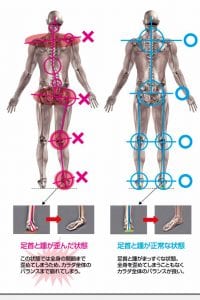 オーダーインソール